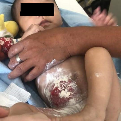 Bebé de cinco meses pasa terrible situación de salud; urge el apoyo ciudadano