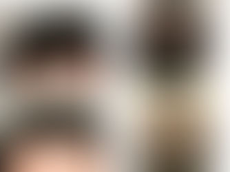 PRP vs Growth Factors for Hair Loss: What’s the Difference and What Works Best?