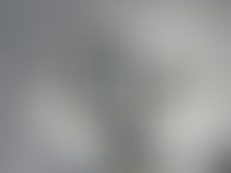 EBRARD ANUNCIA LLEGADA A MÉXICO DE NUEVO TRATAMIENTO CONTRA EL CÁNCER