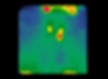 paratiroides3.jpeg