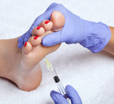 Dermal foot fillers are done at Atlantic Podiatry