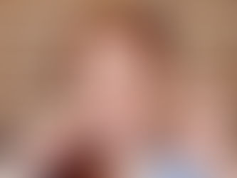 Female with snow-white smile holding white wisdom tooth