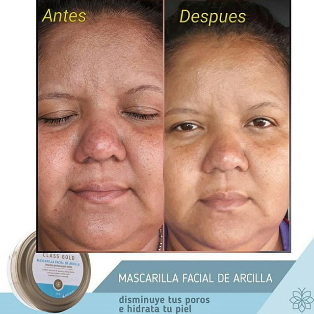 Miniatura: MASCARILLA DE ARCILLA