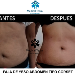testimonios-antes-y-despues-medical-team