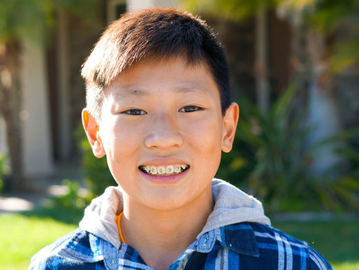 What to Do If My Child Has an Overbite