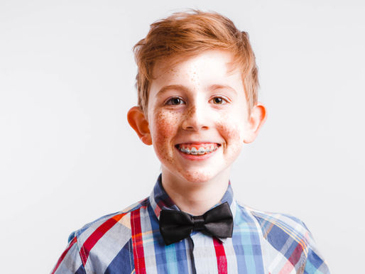 Answers to Common Questions About Orthodontics (Part 3)