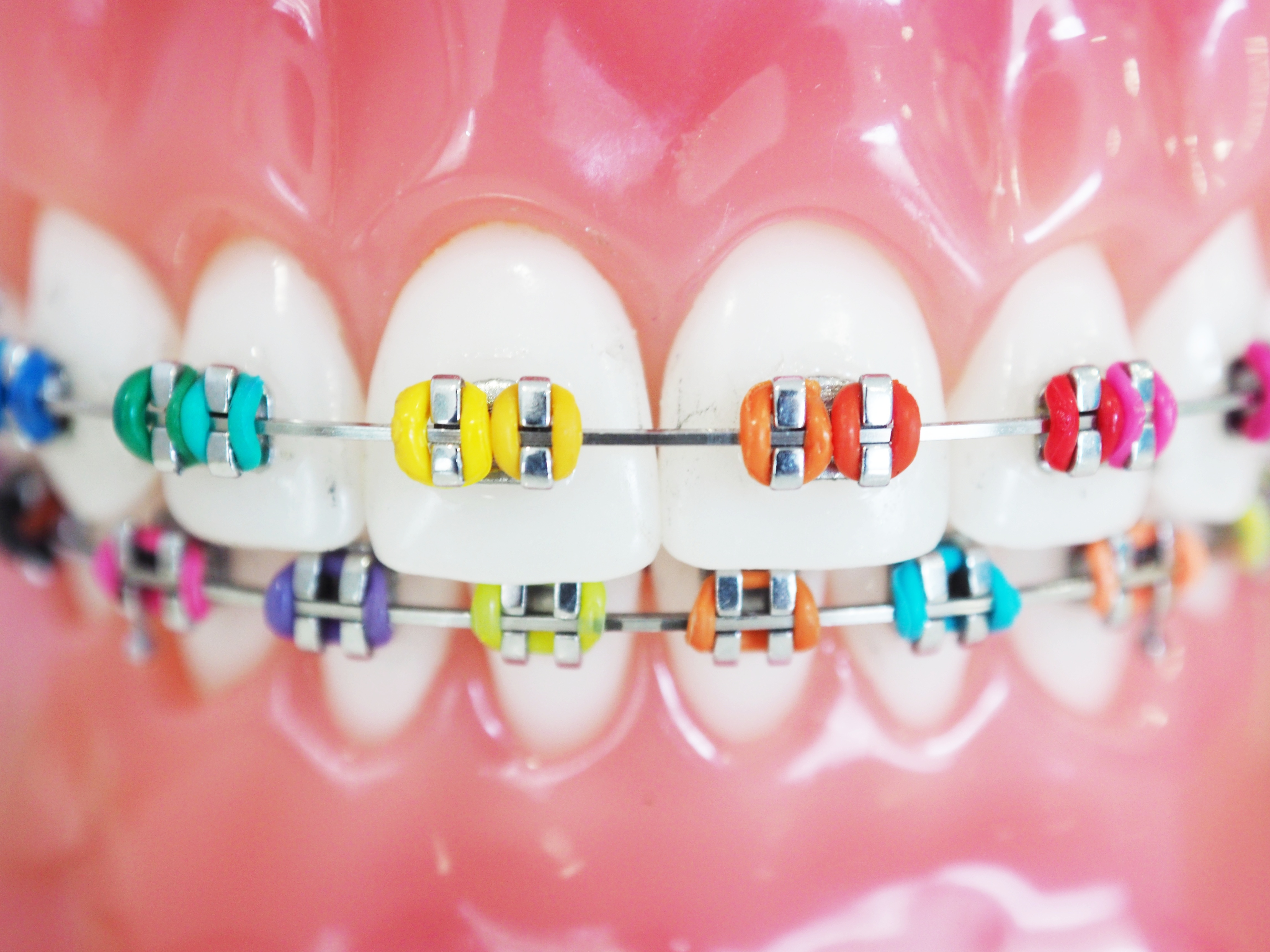 type 3 triangle elastics