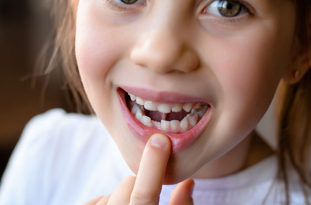 What Does It Mean If My Child Has an Ankylosed Tooth?
