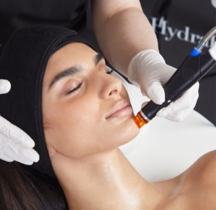A HydraFacial is a ground-breaking form of hydradermabrasion, which uses a unique, patented vortex-fusion delivery system to exfoliate, extract + hydrate the skin. The spiral design delivers painless extractions and leaves lasting results. It is suitable for all skin types and requires no downtime. Results are visible immediately.

We start off with a gentle cleanse + exfoliation, combined with a gentle peel to loosen all that gunk and uncover new layers of skin, resulting in relaxed skin resurfacing. 

Next, using a revolutionary vacuum, we carry out tailored extractions to remove the dirt + debris sitting within the skin, unclog those blocked pores, and target those stubborn problem areas.

To finish off, we use the HydraFacial wand + HydraFacial potions to hydrate your skin. Hydration is carried out using super serums, which are filled with boastful antioxidants, and hyaluronic acid. Voila, you now have nourished and quenched skin.