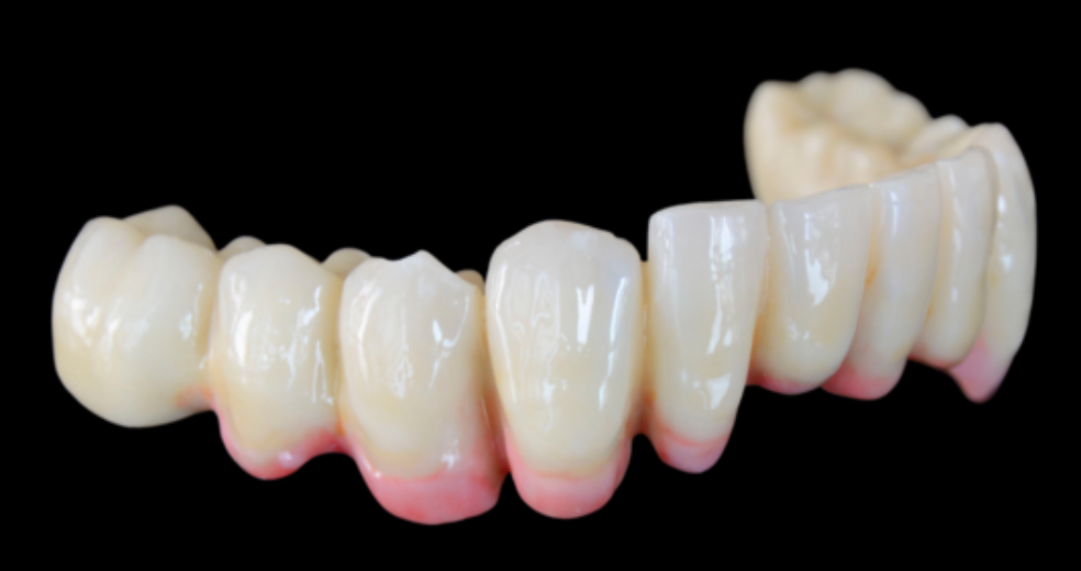 OM Shade - pritidenta MT Plus