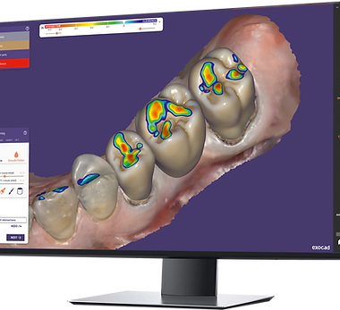 exocad_New_ChairsideCAD_Page_20_Auto-Articulator-Monitor.png