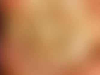 רוץ טופי רוץ