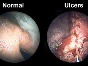 Ulcer Prevention 101: Feeding, Turnout & Stress Strategies Every Rider Should Know