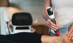 Improving Tendinopathy Outcomes with Shockwave