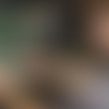 FEA warns of continuing price increases and equipment delays