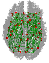 EDI_Schematic_Axial_Simple (1).png