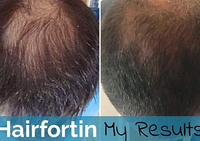 Hairfortin-results.jpg