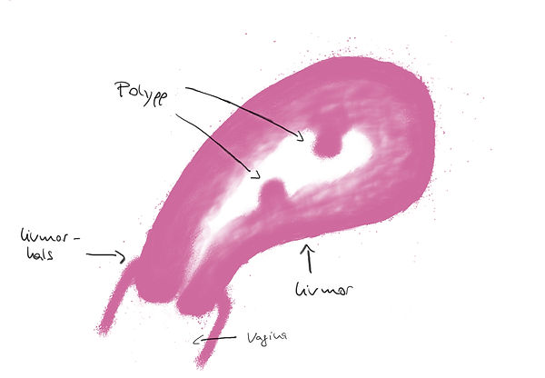 Polyppff.jpg