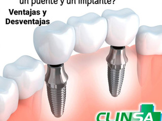 Perdida Dental, Opciones para su Reemplazo.