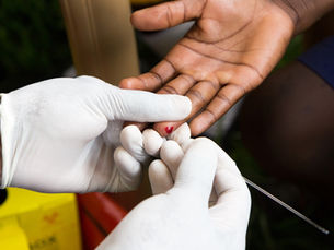 US Aid Cuts Threaten HIV Prevention Progress in South Africa