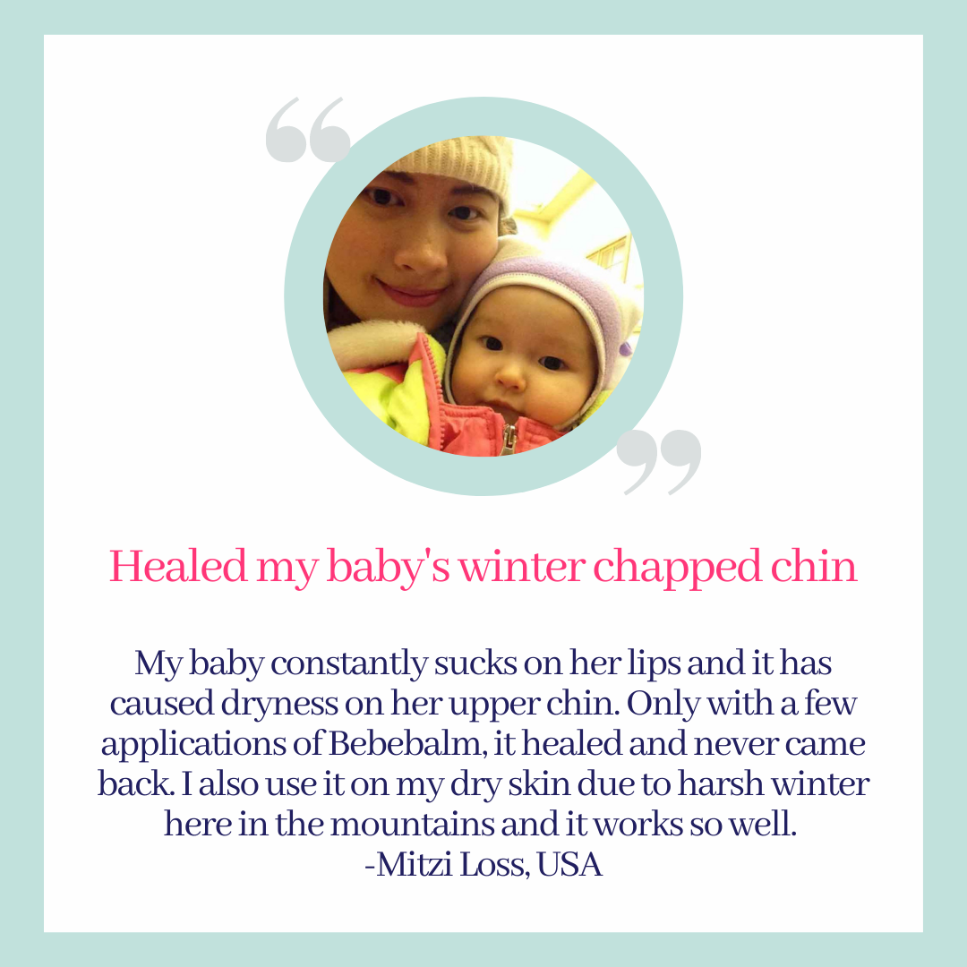 Healed my baby's winter chapped chin