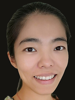 Liming Acupuncture