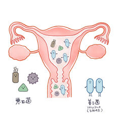 子宮内フローラのイメージイラスト
