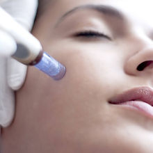 dermapen-micro-needling1.jpeg
