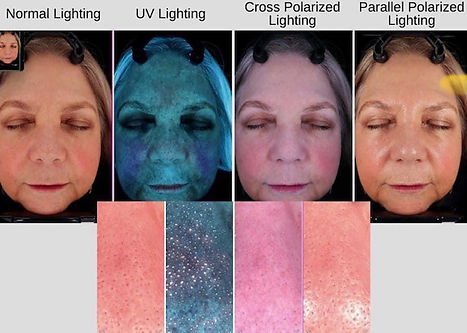 Advanced Skin Analysis by Glam Skin Lab in Orlando, Florida