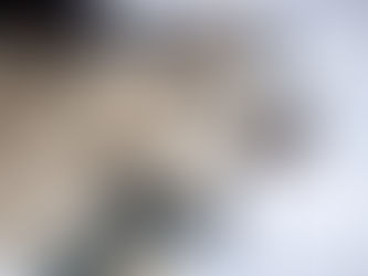 Houston Area Dog Bite? Understanding Texas' "One-Bite Rule" & Your Rights