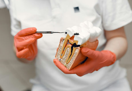 root canal.jpg