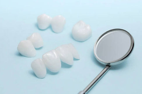 Veneers.jpg