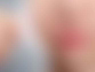 O que é Peeling e como ele age?