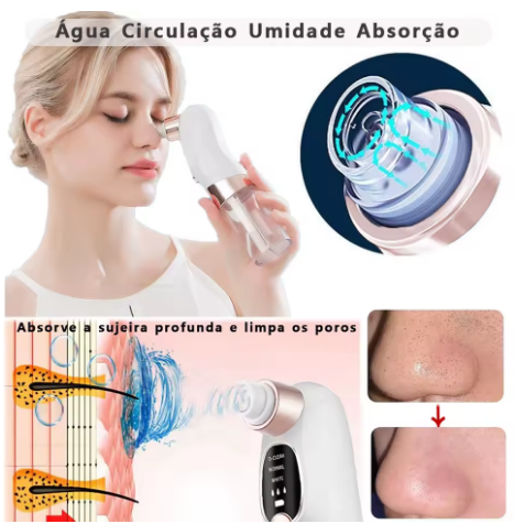 Miniatura: Removedor de Cravos a Vácuo Elétrico para Limpeza Facial, Aparelho USB Recarregá
