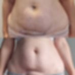 _Post-Op MLD page 2&3 pic (3).jpg