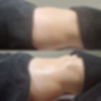 _Post-Op MLD page 2&3 pic (5).jpg