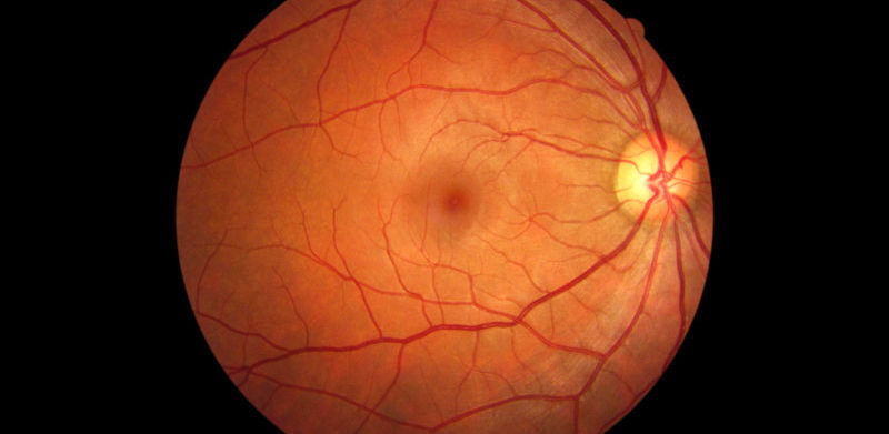 medical retina.jpg