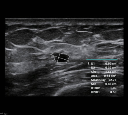 calculadora inteligente.jpg