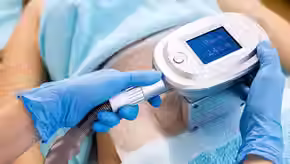 Cryolipolyse Candiac