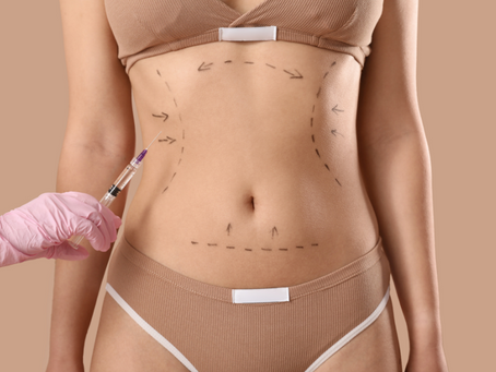 How Liposuction Cost Differs by Technique
