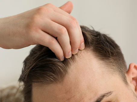 Hair Transplant Scars: What They Look Like and How to Hide