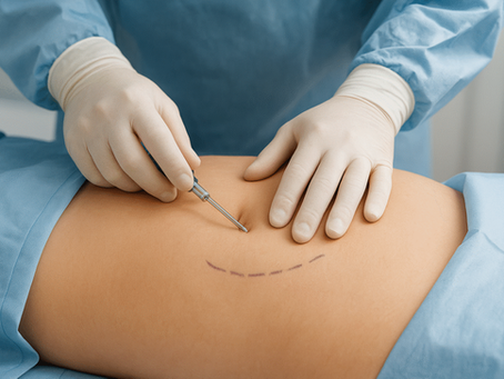 What Makes Enfield Royal Clinic Ideal for Liposuction?