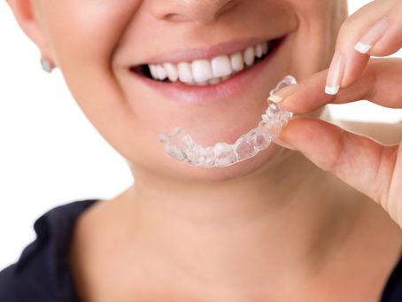Invisalign Braces Treatment for Seniors: Is It Too Late?