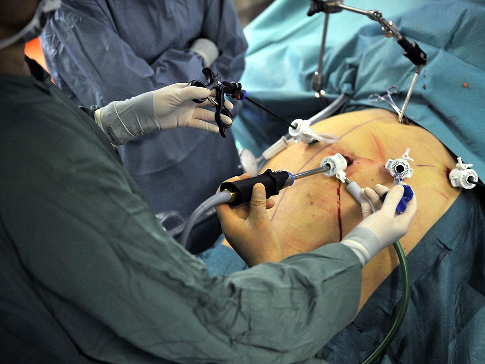 Can Bariatric Surgery Cost Affect Heart Health and Fitness?