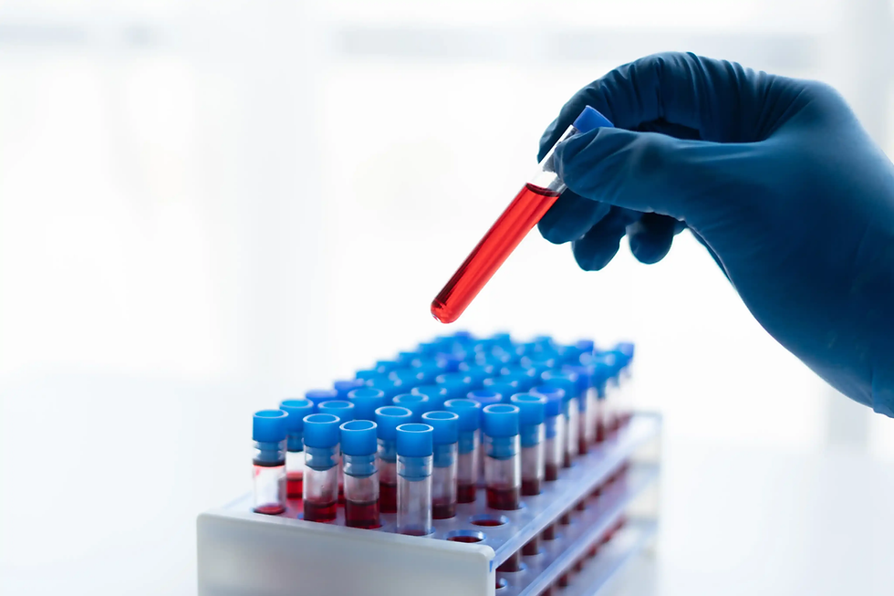 Blood Test at Home for Kids: Safety Tips