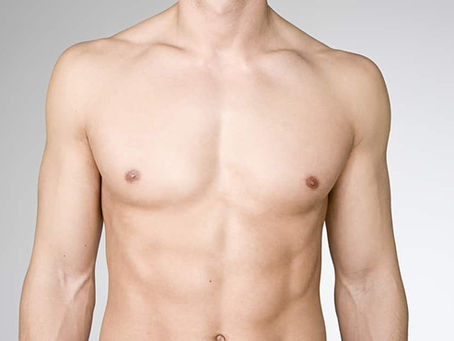 Can Gynecomastia Return After Surgery? Understanding Recurrence