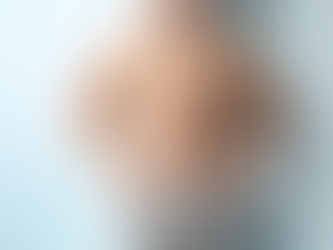 Is Gynecomastia Causing You to Avoid Eye Contact?