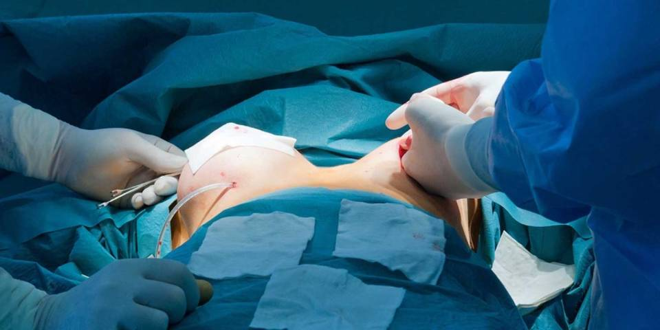 Breast Surgery Clinic: What Affects Procedure Success?