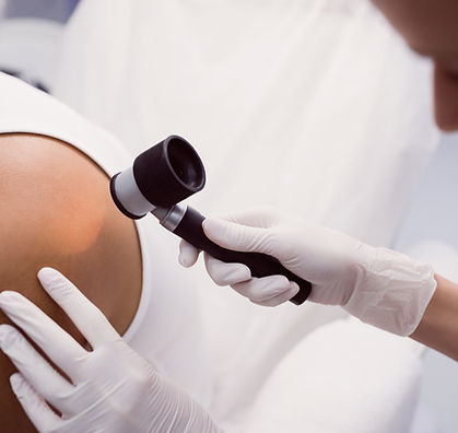 doctor-removing-mole-with-laser-treatment.jpg