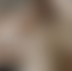 Dementia, Capacity and the Will: Why Australia’s Fastest-Growing Health Crisis Is Reshaping Estate Planning